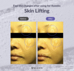 MIZON Hyalugen Le Lift Serum with Hyaluronic Acid and Marine Collagen Wholesale